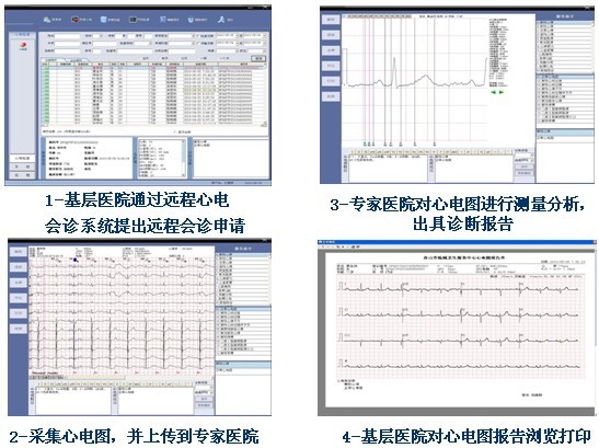 远程心电诊断系统